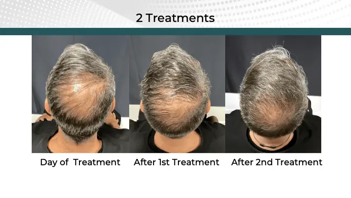 Hair Treatment Before and After