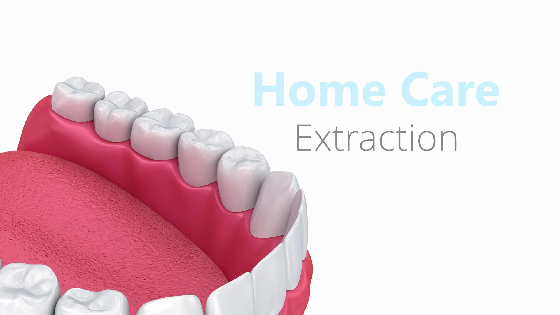 Home Care Extraction
