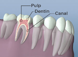 Root Canal Therapy Tooth Anatomy Diagram